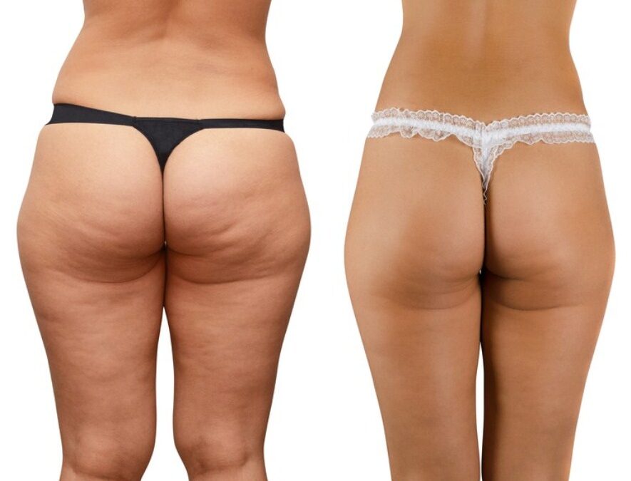 VELLA SHAPE